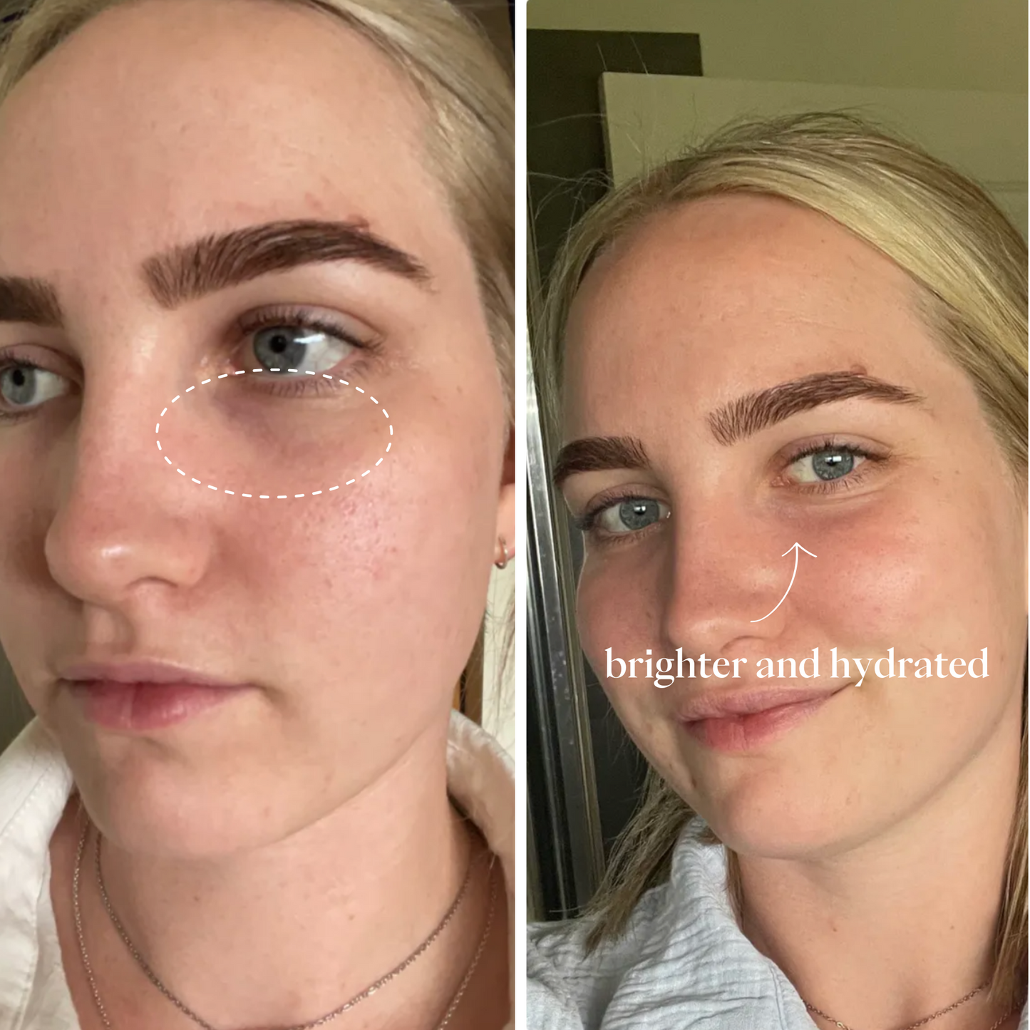 AM to PM: The Eye Set (+ Free Massager) Clean Circle
