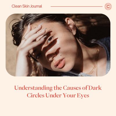 Understanding the Causes of Dark Circles Under Your Eyes: A Comprehensive Guide